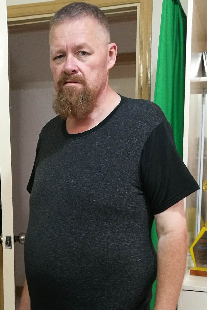 Compression Clothing Advantages for Massive Weight Loss 430 To Fit